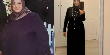 Azmetti 22 ayda çok zayıfladı
