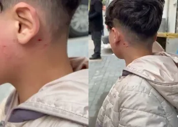 Camı tıklattığı için çocuğu darp etti