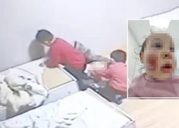 Kreşte akran zorbalığı! 2 yaşındaki çocuk darp edildi