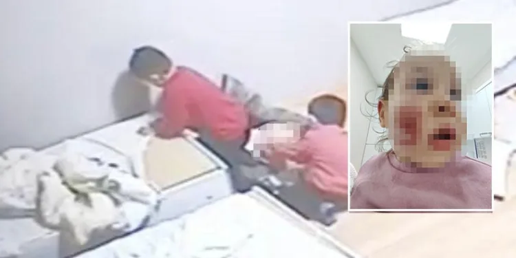 Kreşte akran zorbalığı! 2 yaşındaki çocuk darp edildi