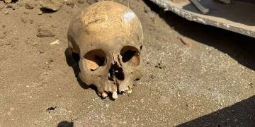 İnşaat işçileri kafatası buldu