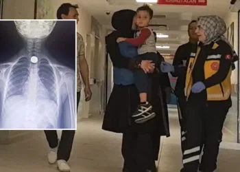 Bursa’da çocuğun yuttuğu para yemek borusuna takıldı