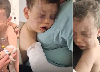 Kan donduran olay! 2 yaşındaki bebek öldüresiye dövüldü