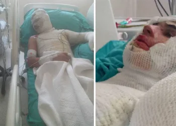 Yeğenini yakan amca, suçu ağabeyine attı
