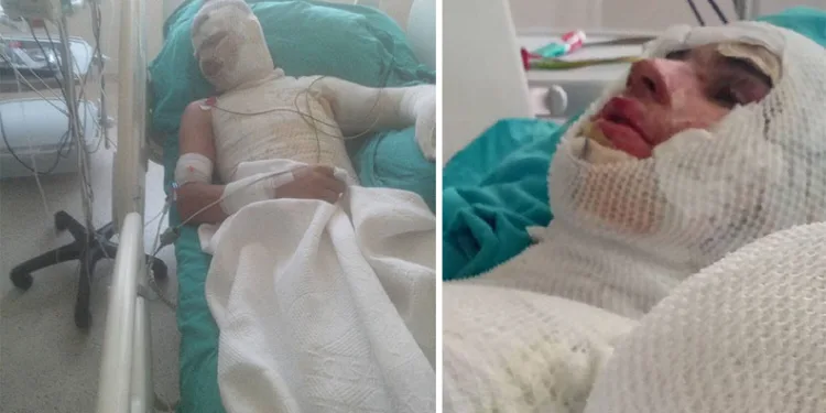 Yeğenini yakan amca, suçu ağabeyine attı