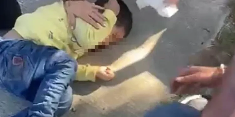 Yürüyüş yoluna giren motosikletli 3,5 yaşındaki çocuğa çarptı