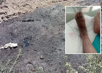 Fabrikanın tarlaya bıraktığı asit, çocuğun hayatını alt üst etti