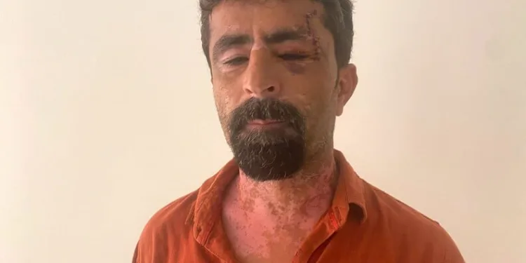 Buzdolabını servise gönderdi, başına gelmeyen kalmadı