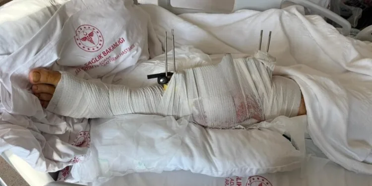 Duble yolda iki otomobil çarpıştı: 1’i ağır, 3 yaralı