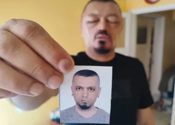 Berberin tavsiyesiyle aldığı şampuan adamı beter etti