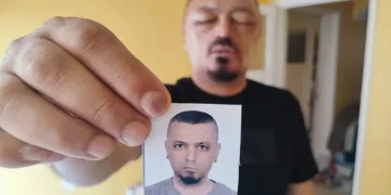 Berberin tavsiyesiyle aldığı şampuan adamı beter etti