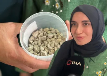 Genç kızın vücudundan 287 adet taş çıkarıldı