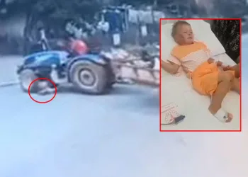 Bursa’da otomobil bisikletli çocuğa çarptı