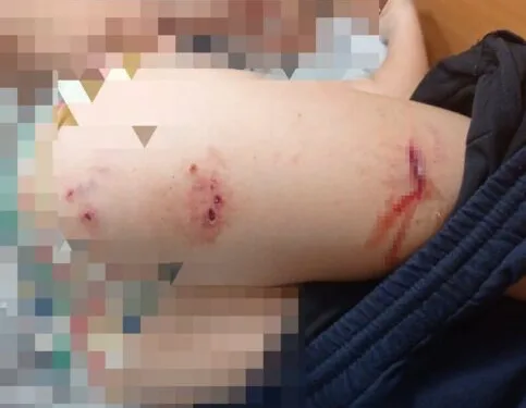 Yaşlı kadının şüpheli ölümünde torunu gözaltına alındı
