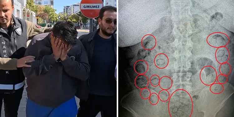 İranlı tacir, yutup midesine sakladığı 433 gram uyuşturucuyla yakalandı
