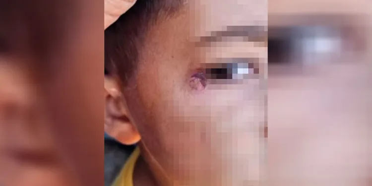 Öğrencinin yüzünde sigara söndüren temizlik görevlisi tutuklandı