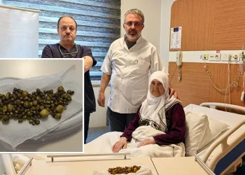 77 yaşındaki kadının safra kesesinden 213 adet taş çıktı