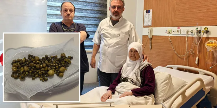 77 yaşındaki kadının safra kesesinden 213 adet taş çıktı