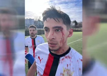Maç sonrası saha içi savaş alanına döndü