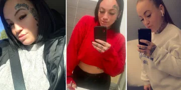 Antalya’da karın gerdirme ameliyatı olan kadın hayatını kaybetti