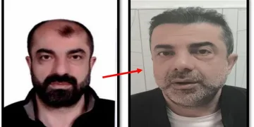 Ameliyatla yüzünü değiştiren cinayet zanlısı yedi yıl sonra yakalandı