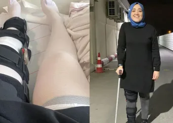 Özel Hastanede Akılalmaz Hata: Sakat Diz Yerine Sağlam Olanı Ameliyat Etti