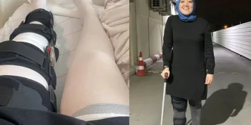Özel Hastanede Akılalmaz Hata: Sakat Diz Yerine Sağlam Olanı Ameliyat Etti