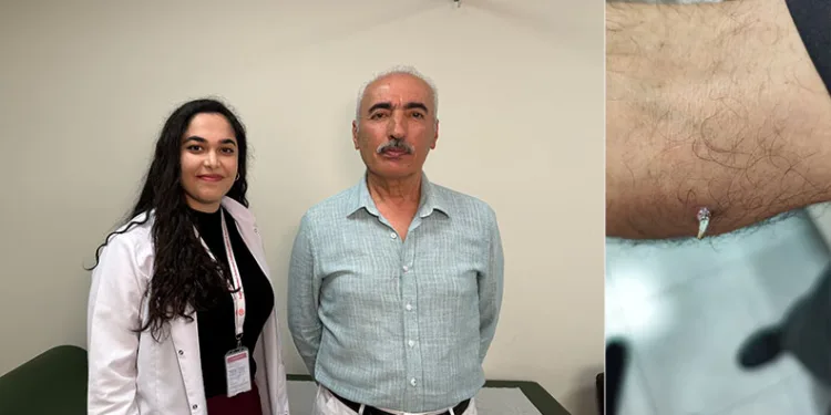 Kolundaki yara için gitti, kanser olduğunu öğrendi