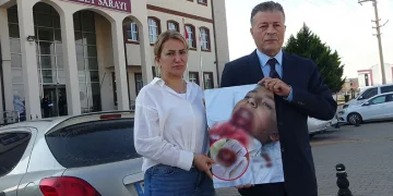 Çanakkale’de demir saplanan çenesi parçalanan öğrencinin davasında 4’üncü duruşma görüldü