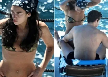 Dua Lipa’nın eşinin sırtındaki izler dikkat çekti