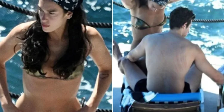 Dua Lipa’nın eşinin sırtındaki izler dikkat çekti