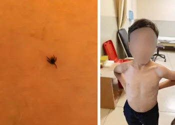 İnegöl’de kene alarmı
