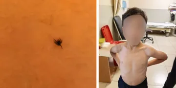 İnegöl’de kene alarmı