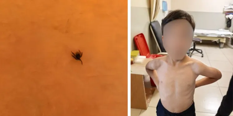 İnegöl’de kene alarmı
