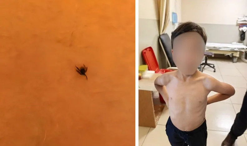 İnegöl’de kene alarmı