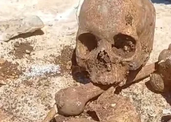 Malatya’da temel kazısında insan kemikleri bulundu