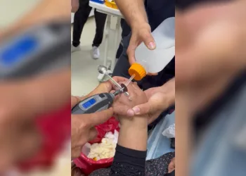 Yüzüğü parmağına sıkışan kadının yardımına itfaiye koştu