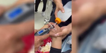 Yüzüğü parmağına sıkışan kadının yardımına itfaiye koştu