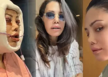 Didem Ceran Kore’de yüz nakli yaptırmıştı! ‘Cenazen ülkeye dönsün’ yorumlarına sert çıktı
