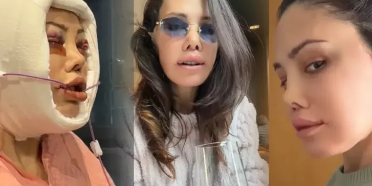 Didem Ceran Kore’de yüz nakli yaptırmıştı! ‘Cenazen ülkeye dönsün’ yorumlarına sert çıktı