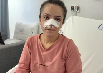 Eşinin kopardığı burnu başarılı operasyonla yerine dikildi