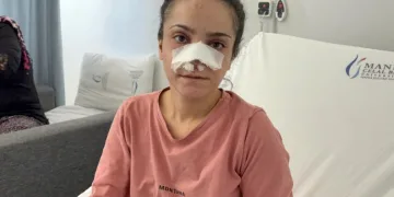 Eşinin kopardığı burnu başarılı operasyonla yerine dikildi