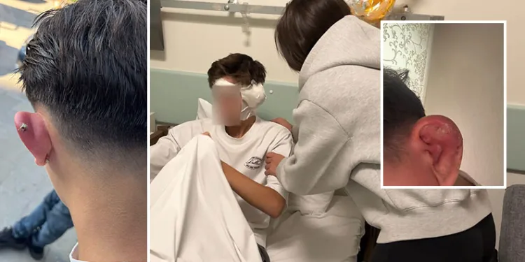 Bursa’da piercing kabusu: Kulağı şişen çocuk hastanelik oldu